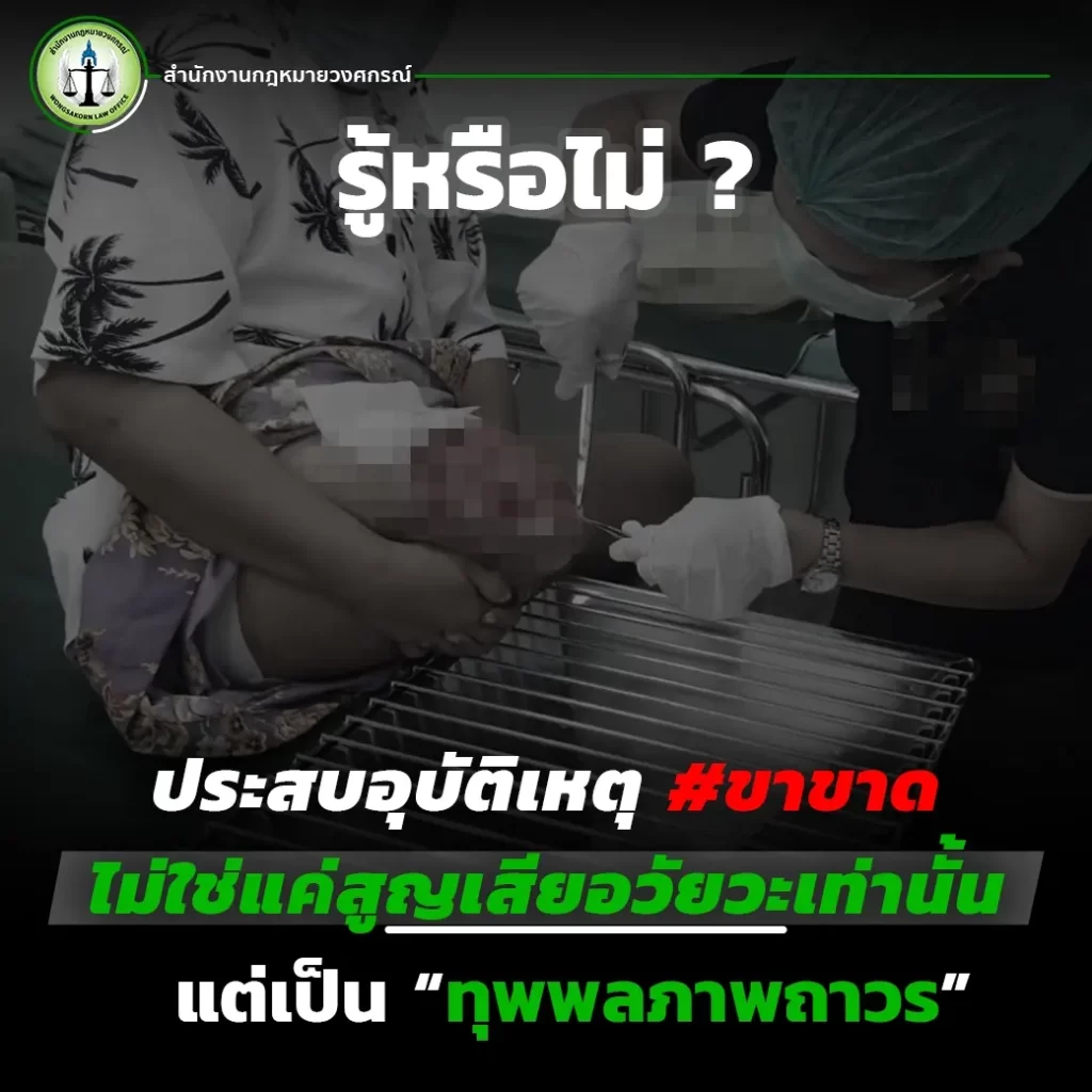 รู้หรือไม่ ประสบอุบัติเหตุ #ขาขาด ไม่ใช่แค่สูญเสียอวัยวะเท่านั้น แต่เป็น “ทุพพลภาพถาวร”