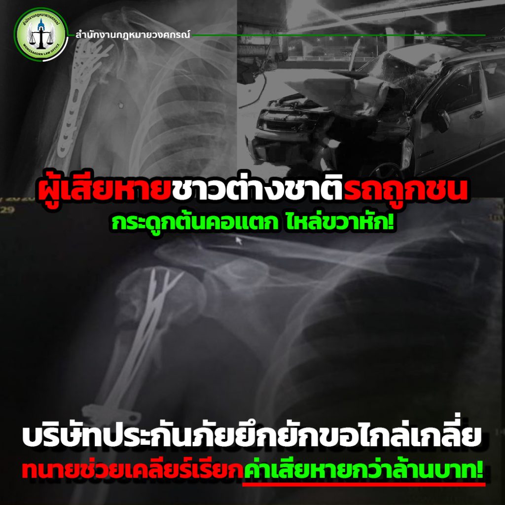 ผู้เสียหายชาวต่างชาติรถถูกชนกระดูกต้นคอแตก ไหล่ขวาหัก! บริษัทประกันภัยยึกยักขอไกล่เกลี่ย ทนายช่วยเคลียร์เรียกค่าเสียหายกว่าล้านบาท!